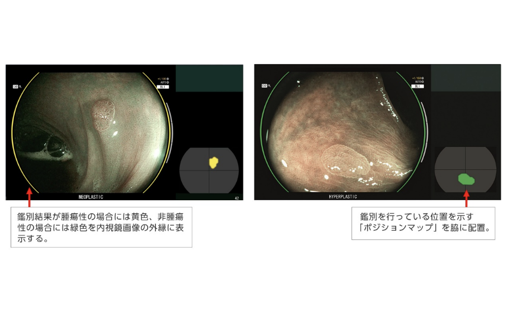 疾患鑑別支援機能